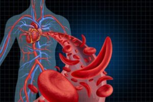 graphic of sickle cells and the path they take in the blood stream